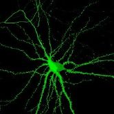 Anhand von Nervenzellen (hier grünleuchtend im Bild) will Schratt der Molekülklasse der microRNAs auf die Spur kommen.