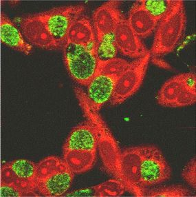 Im ERA-NET PathoGenoMics wird an einer Reihe von krankheitsauslösenden Bakterien geforscht, unter anderem an Chlamydien.