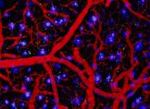 Die blau angefärbten beta-Amyloid-Ablagerungen sind zwischen den roten Blutgefäßen im Gehirn einer an Alzheimer erkrankten Maus deutlich zu sehen. Mit der Gleichung können die Wissenschaftler auch Störungen in äußerlich unauffälligen Zellen nachweisen.