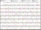 Um die microRNA-182 zu identifizieren haben die Forscher unzählige kleine RNA-Moleküle untersucht. Ihre Sequenz lässt sich aus sogenannten Interferogrammen ableiten.