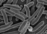 Bakterien des Typs Escherichia coli könnten helfen, das Immunsystem gegen Tumore in Stellung zu bringen.