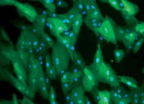 Zellen mit eingebauten Bitterrezeptoren als Geschmackstester: In der strategischen Allianz Natlife 2020 fahnden Biotechnologen nach Naturstoffen, die bitteren Geschmack maskieren können.