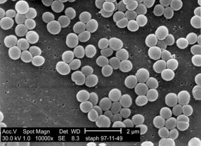 Bakterien vom Typ Staphylococcus aureus sind häufig für schwere Wundinfektionen verantwortlich. Die Forscher im Verbundprojekt SkinStaph haben ihnen den Kampf angesagt.