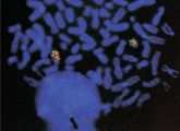 Drexlers Steckenpferd: Einzelzellanalyse von leukämischen Zellen in der Metaphase mit der FISH-Technik (Fluoreszenz in Situ Hybridisierung).