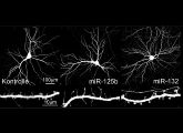 Eine erhöhte Konzentration zweier microRNAs hat Einfluss auf die Steuerung der Synapsenbildung von Nervenzellen.