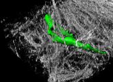 Fibroblasten (grün) überwuchern bei bestimmten Erkrankungen das gesunde Lungengewebe. Fibroblasten können für Laborversuche in einer Kollagenmatrix (grau) kultiviert werden.