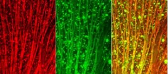 Fischers Forschungsobjekte im Visier: Nervenzellen der Netzhaut. Rot: Diese Zellen sind mit einem Antikörper gefärbt. Grün: diesselben Zellen, die ein künstlich induziertes Protein bilden. Gelb: Überlagerung beider Bilder.