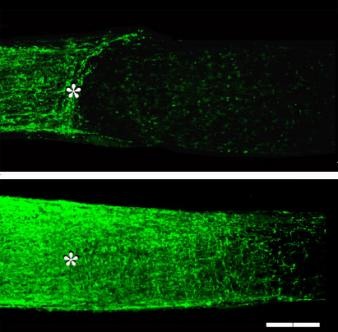 Normalerweise regenerieren Nervenzellen in verletzten (mit Sternchen markierte Stelle) Sehnerven nicht. (oben) Nach Behandlung mit einer Linsenverletzung können Axone wieder nachwachsen. (unten)