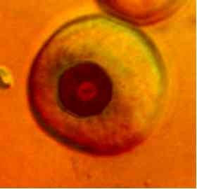 So sehen Zellen auf dem Bio-Chip aus, mit dem sich das Verhalten von Kanal-Molekülen in Zellen analysieren lässt.