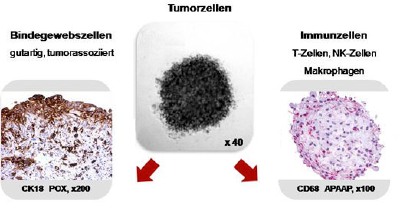 Sperotec bietet Testsysteme mit Tumor- und verschiedenen gutartigen Zelltypen an, mit denen sich der Einfluß des Mikromillieus auf  die Arzneimittelwirkung untersuchen lässt.