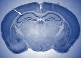 Durch Einfärbung im Vorderhirn der Maus sichtbar gemacht: Der Serum Response Factor regelt das Ablesen der Gene in allen Wirbeltieren.