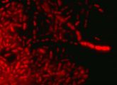 In der fluoreszenzmikroskopischen Aufnahme erscheinen die Aquincola tertiaricarbonis-Bakterien rot, weil der zugesetzte Farbstoff ihren Speicherstoff Polyhydroxybuttersäure leuchten lässt. 