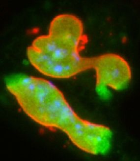 Das Protein Emerin unter dem Elektronenmikroskop.