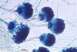 Mikroskopische Vergrößerung von A.fumigatus sporenenthaltenden Conidien-Köpfen 