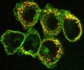 GFP-gekoppelt-an-ein-oberflächenprotein