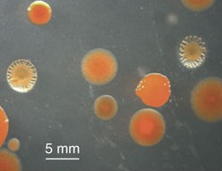 Das Bodenbakterium Sorangium cellulosum zeichnet sich durch die Bildung von Kolonien aus.