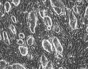 So sehen embryonale Stammzellen von Mäusen aus, die durch bisherige Techniken gewonnen wurden.