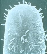 Agrobakterien sammeln sich an Pflanzenzellen. Der DNA-Transfer kann beginnen.