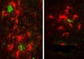 Alzheimer-Amyloidablagerungen (grün markiert) im Hirn von unbehandelten (linkes Bild) und behandelten (rechtes Bild) Mäusen.