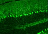 GFP ermöglicht auch die Beobachtung menschlicher Nervenzellen. Hier leuchten im Kleinhirn beheimatete Purkinje-Zellen.