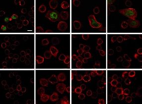 Göttinger Forscher haben an Versuchen mit Ratten die Wirkungsweise des Antikörpers entschlüsselt, den die Biotech-Firma Tegenero 2006 einst als Therapeutikum entwickeln wollte.