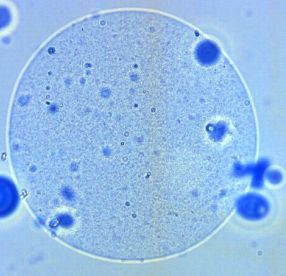 Wissenschaftler aus Weihenstephan haben schützende Mikrokapseln für probiotische Keime entwickelt. 