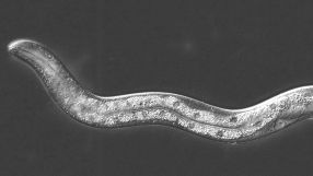 Der Fadenwurm ist ein idealer Modellorganismus für Biologen: Seine Zellzahl und sein Lebenszyklus sind überschaubar und die Forschungsergebnisse lassen sich zum Teil auf den Menschen übertragen.