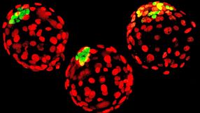 Mäusembryonen, bei denen die Anlagen für den späteren Fetus grün eingefärbt sind. Fehlt der Stammzellfaktor Oct4 (Mitte und rechts), hat das auf die Embryonalentwicklung keinen Einfluss. Entscheidend ist Oct4 für die Herstellung von pluripotenten Stammzellen.