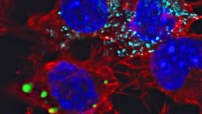 Mikroskopaufnahme von Nervenzellen mit fluoreszierenden Markierungen: Der Kontakt von Zellen, welche Proteinpartikel produzieren (hier türkis), führt in Nachbarzellen ebenfalls zu Ablagerungen desselben Proteins (grün). Die Zellkerne sind blau markiert.