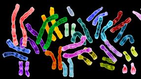 Haben Nervenzellen zu viele Chromosomen, sterben sie bereits früh und verursachen so Alzheimer, vermuten die Leipziger Forscher.