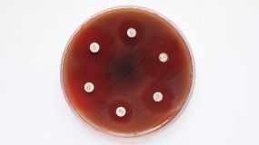 Forscher haben mit Hilfe des Hemmhoftests nachgewiesen, dass das Antibiotikum Trimathoprim  gegen das Bakterium Streptococcus pyogenes weniger resistent ist als angenommen.