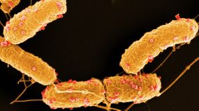 Phagen (hier rot gefärbt) könnten im Kampf gegen multiresistente Keime- wie Achromobacter- eine neue Therapiealternative zur Antibiotika sein.