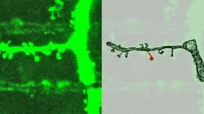 Die Fortsätze der Nervenzelle entstehen beim Reiz durch Lernen. An den Enden der Fortsätze befinden sich Synapsen (links Original, rechts Rekonstruktion) Wächst die Synapse mit einem ausgewogenen Verhältnis aller Komponenten, bleibt sie auch über längere Zeiten stabil.