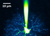 Astrozyt im Hirngewebe: Über eine Pipette wird ein fluoreszierender Farbstoff in eine Zelle eingebracht. Mithilfe der Zweiphotonen-Fluoreszenzmikroskopie können dann feinste Details tief im Gewebe dargestellt werden.