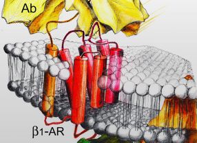 Nach einer Beschädigung der Herzmuskelzellen präsentieren diese dem Immunsystem bestimmte Strukturen (rot). Es entstehen Autoantikörper (gelb) im Blut, die gezielt den Herzmuskel angreifen. Diese Attacken sind womöglich die Ursache für die immunbedingte Herzschwäche.