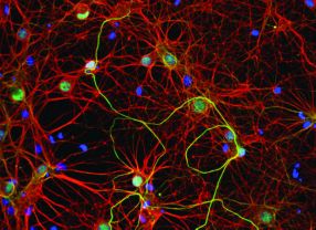 Aufnahme einer primären Zellkultur hippocampaler Neuronen. Angefärbt sind DNA- (blau), βIII-Tubulin- (rot) und Neurofilament- (grün) Moleküle.