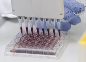 Unter dem Dach von Eurotransbio werden translationale Konsortien von kleinen und mittleren Unternehmen finanziell unterstützt.