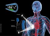 Licht hören: Laserblitze erzeugen Ultraschallwellen, die von Mikrophonen eingefangen und später zu dreidimensionalen Bildern verarbeitet werden. (Ausschnitt oben mit grün markieter Arteriosklerose)