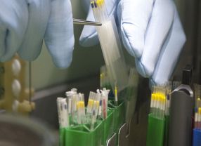 In der Biobank der Bevölkerungsstudie LIFE werden demnächst über eine Million Blut- und Zellproben bei durchgehend 140 Grad Celsius eingelagert werden. 