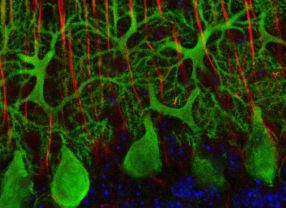 Das Merlin-Eiweiß (grün) kann im Gehirn die Verästelung von Nervenzellen eindämmen. Forscher aus Jena und Bonn vermuten, dass ein Zuviel an dem zauberhaften Protein an der Entstehung von Autismus beteiligt sein könnte.