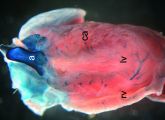 Die beiden microRNAs finden sich in den glatten Gefäßmuskelzellen, zum Beispiel an verschiedenen Stellen im Herz.