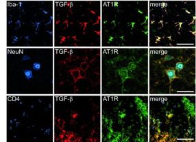 Das Forscherteam untersuchte die Expression von TGF-beta und Angiotensin in verschiedenen Zellen, um den Zusammenhang zwischen beiden Molekülen zu erforschen.