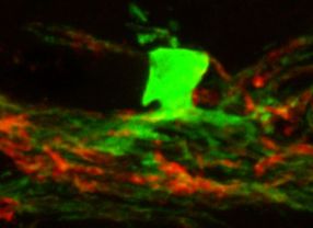 Die umprogrammierter Neuralleisten-Stammzellen übernehmen nach der Übertragung ins Gehirn von Mäusen, die kein Myelin produzieren können, diese Aufgabe: Sie bilden Oligodendrozyten (grün), die Myelin (rot) herstellen.