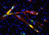 Mit Hilfe synthetischer RNA-Moleküle ist es US-Forschern gelungen, Hautzellen in den Alleskönner-Zustand zurückzuprogrammieren. Damit bringen sie die iPS-Technik einen entscheidenden Schritt voran. 