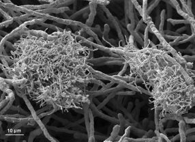 Flocken des Bakteriums Streptomyces hygroscopicus in engem Kontakt mit Mycel von Aspergillus nidulans.