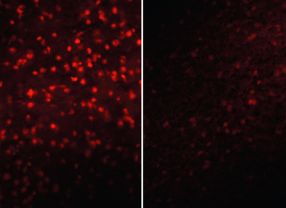 Aggressive Sauerstoffverbindungen - zu denen auch Wasserstoff-Peroxid gehört - lassen sich mit speziellen Farbstoffen anfärben. Rechts sind Tiere zu sehen, bei denen ein Hemmstoff die Konzentration von Wasserstoff-Peroxid vermindert hat, links Tiere ohne Behandlung.