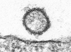 Das Schmallenberg-Virus ist ein exotisches Orthobunya-Virus. Forscher des FLI in Riems haben den Tierseuchen-Erreger aufgespürt und erstmals auch im Elektronenmikroskop sichtbar gemacht.