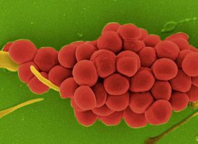 Rasterelektronenmikroskopische Aufnahme des Sepsis-Erregers Stapylococcus aureus. In jüngster Zeit macht S. aureus vor allem durch die rasante Entwicklung von Antibiotikaresistenzen von sich reden. Bestimmte Erreger sind inzwischen gegen mehrere klinisch gebräuchliche Antibiotika resistent und stellen Mediziner so vor große Probleme.