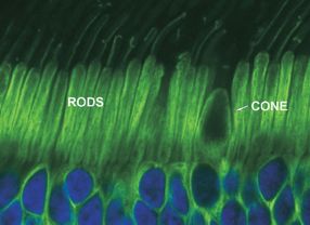 Auf der Netzhaut befinden sich zwei Rezeptortypen: Stäbchen (Rod) und Zapfen(Cone). Deutsche Forscher konnten mittels Gentherapie die Funktionsfähigkeit von defekten Zapfen wiederherstellen.