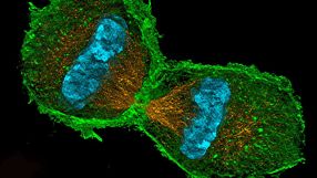 Die Themen der SFB sind breit gefächert. Der neue SFB „Chromatindynamik“ von der Universität München erforscht die Vielgestaltigkeit und Flexibilität des Chromosomenmaterials.